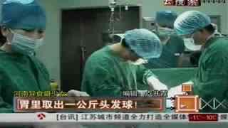 异食癖视频,奇特的饮食习惯背后的科学之谜